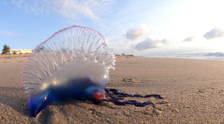 Liam stung by a Jellyfish